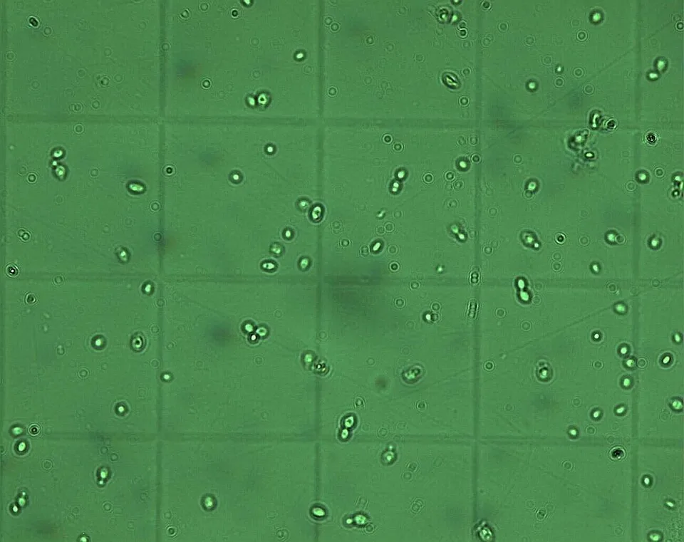 Brettanomyces